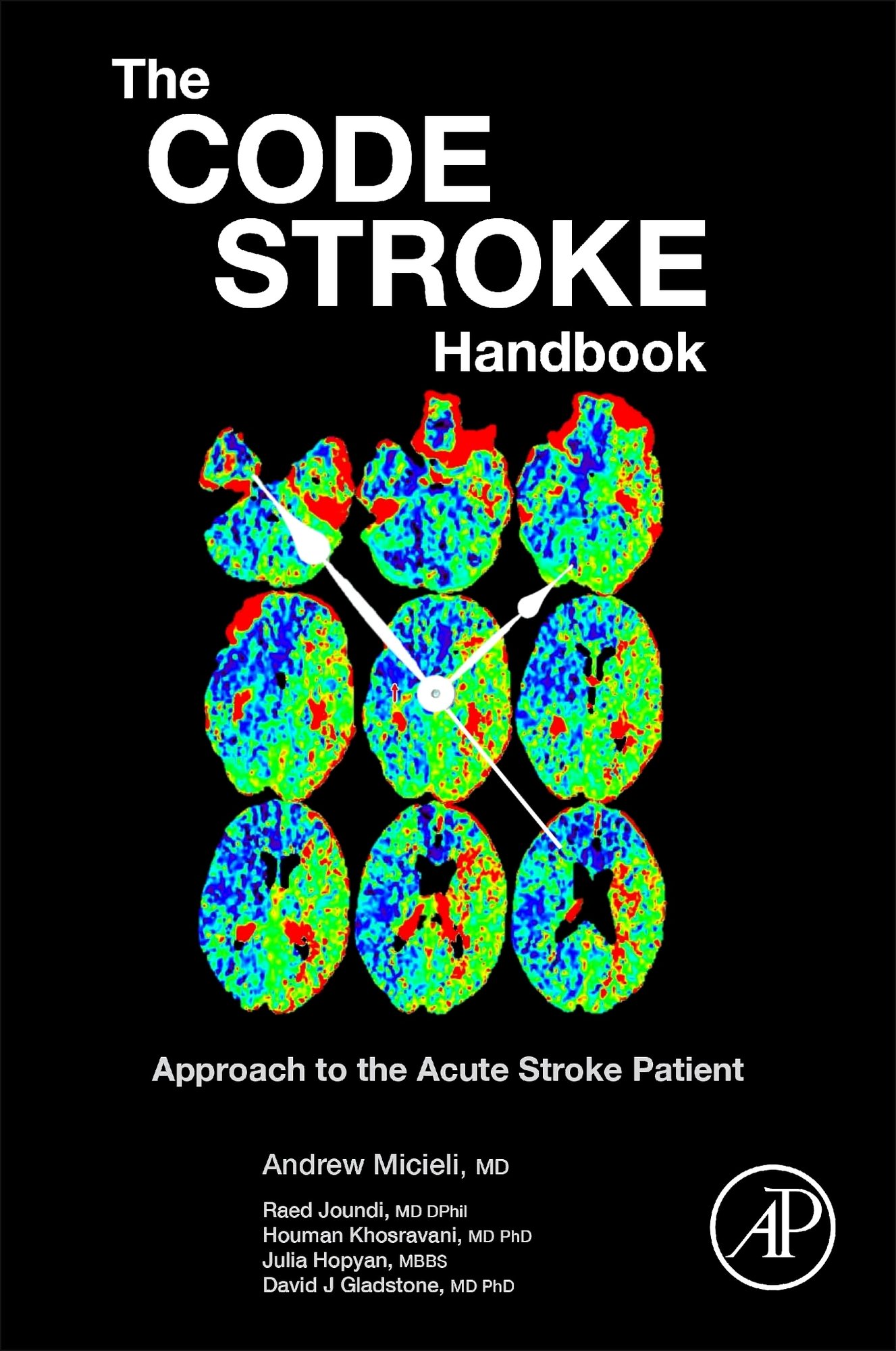 The Code Stroke Handbook Approach to the Acute Stroke Patient Micieli Joundi