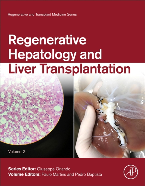 Regenerative Hepatology and Liver Transplantation Martins Baptista Volume 2