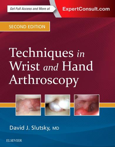Techniques in Wrist and Hand Arthroscopy Slutsky Hardback Elsevier 2e