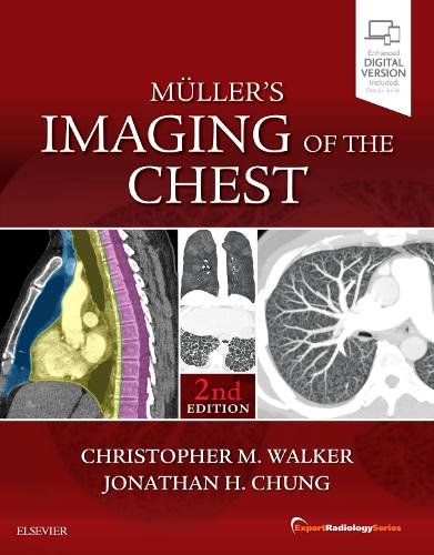 Muller’s Imaging of the Chest Expert Radiology Series Walker Chung Hardback 2e