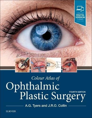 Colour Atlas of Ophthalmic Plastic Surgery Tyers Collin Hardback 4e