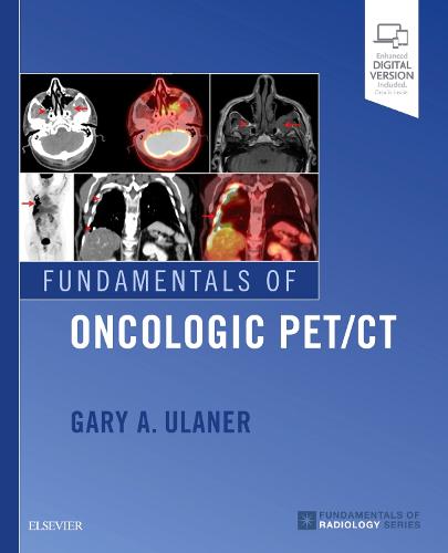 Fundamentals of Oncologic PET/CT Ulaner Paperback 9780323568692