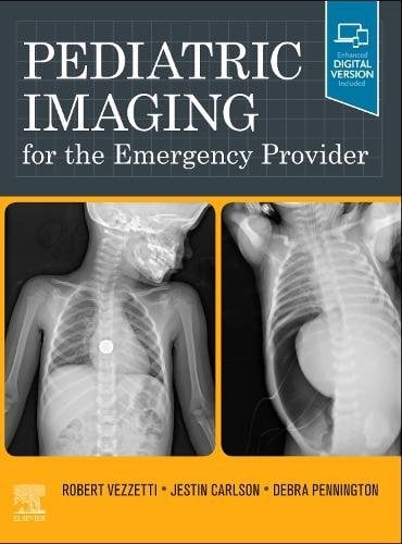 Pediatric Imaging for the Emergency Provider Vezzetti Carlson Pennington
