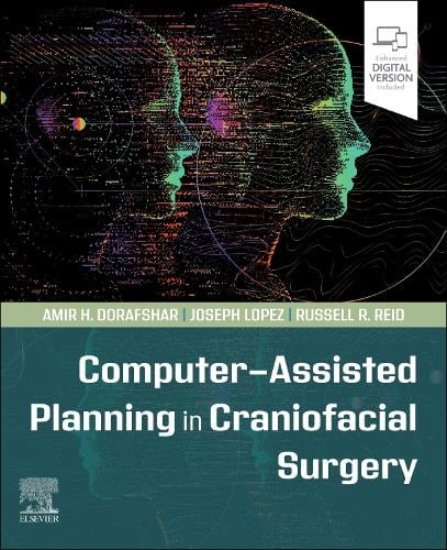 Computer-Assisted Planning in Craniofacial Surgery Dorafshar Lopez Reid Elsevier