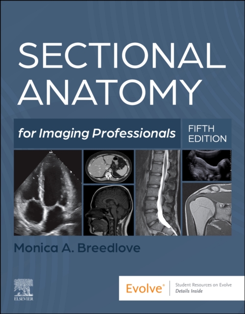 Sectional Anatomy for Imaging Professionals Breedlove Paperback Elsevier 5e