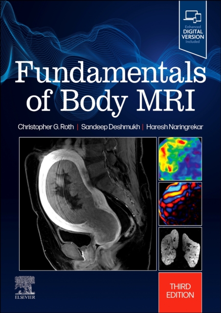 Fundamentals of Body MRI Roth Naringrekar Deshmukh Paperback Elsevier 3e