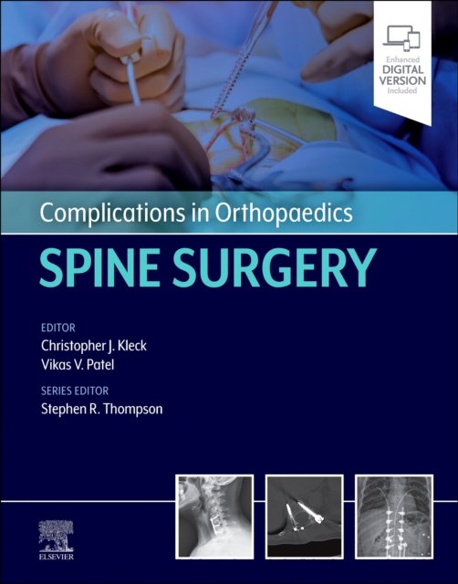 Complications in Orthopaedics: Spine Surgery Patel Kleck Thompson Hardback