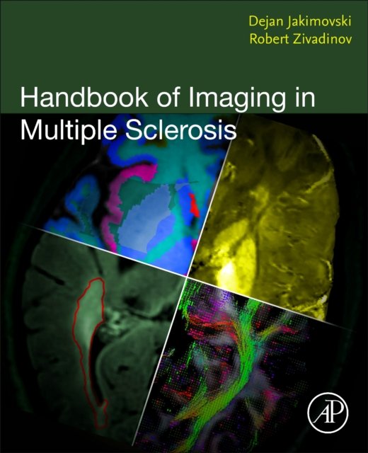 Handbook of Imaging in Multiple Sclerosis Jakimovski Zivadinov Paperback