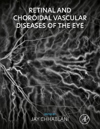 Retinal and Choroidal Vascular Diseases of the Eye Chhablani Paperback