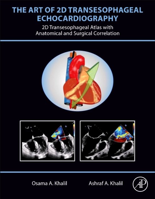 The Art of 2D Transesophageal Echocardiography Khalil Khalil Hardback