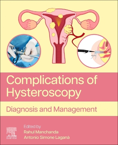Complications of Hysteroscopy Diagnosis and Management Manchanda Laganà Elsevier