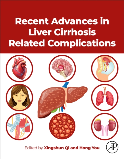 Recent Advances in Liver Cirrhosis Related Complications Qi You Paperback