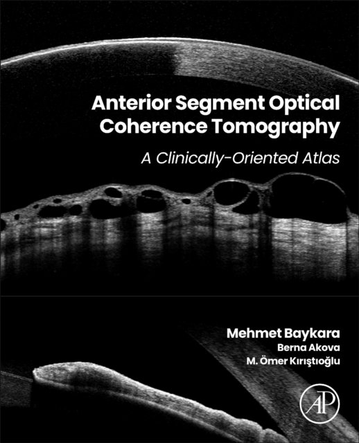 Anterior Segment Optical Coherence Tomography A Clinically-Oriented Atlas