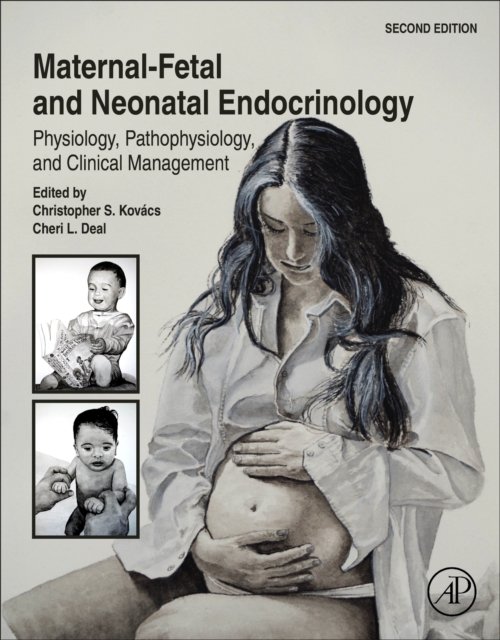 Maternal-Fetal and Neonatal Endocrinology Kovács Deal Hardback Academic Press 2e
