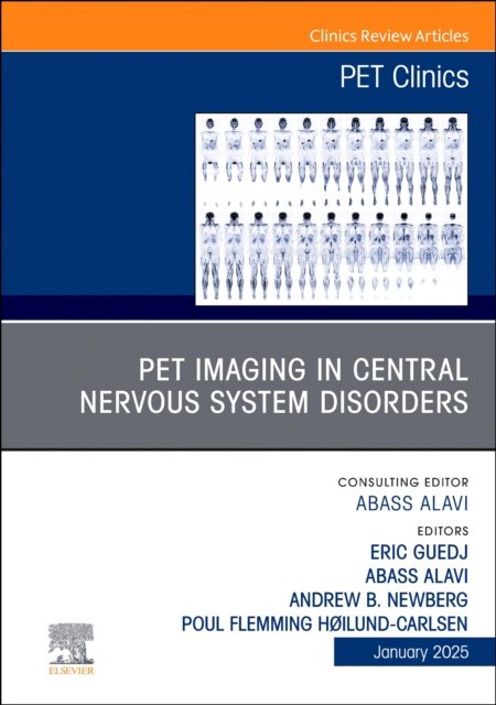 PET Imaging in Central Nervous System Disorders, An Issue of PET Cl… Volume 20-1