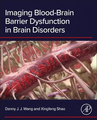 Imaging Blood-Brain Barrier Dysfunction in Brain Disorders Wang Shao Paperback