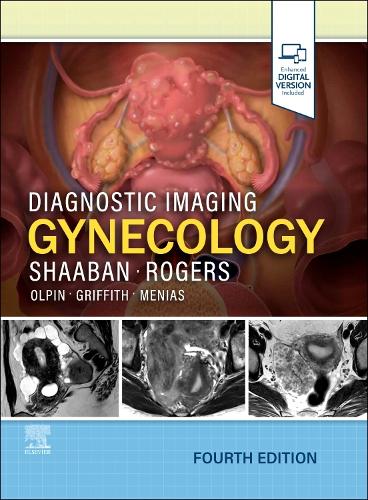 Diagnostic Imaging: Gynecology Shaaban Rogers Hardback Elsevier 9780443380396 4e