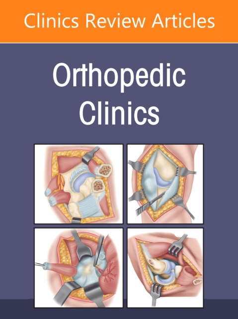 Sports-Related Injuries, An Issue of Orthopedic Clinics Azar Volume 56-4