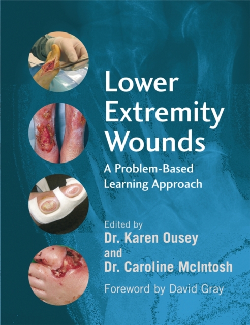 Lower Extremity Wounds – A Problem–Based Learning Approach Ousey Paperback
