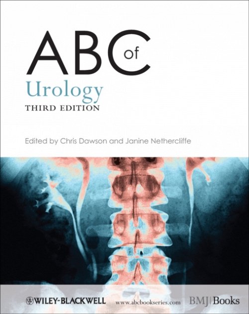 ABC of Urology 3e Dawson Paperback Wiley–Blackwell 9780470657171