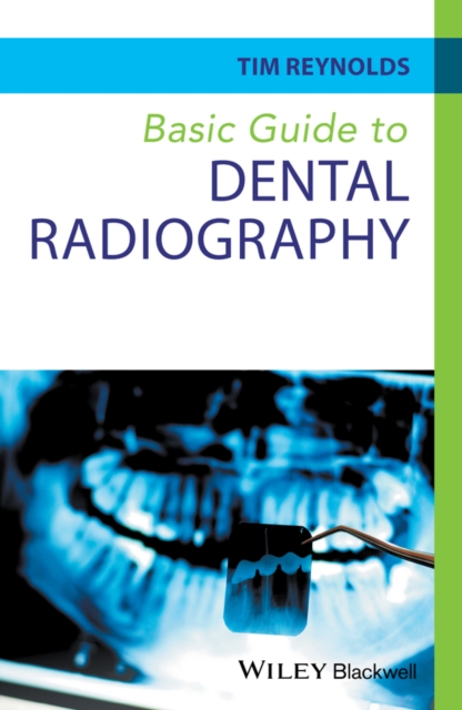 Basic Guide to Dental Radiography Reynolds Paperback Wiley–Blackwell