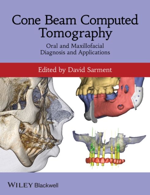 Cone Beam Computed Tomography – Oral and Maxillofacial Diagnosis and Applicatio…