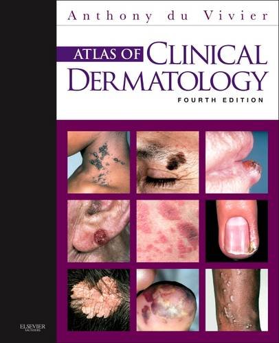 Atlas of Clinical Dermatology du Vivier Hardback Saunders 9780702034213 4e