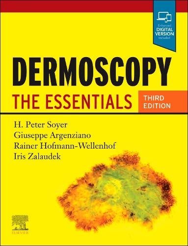 Dermoscopy The Essentials Soyer Argenziano Hofmann-Wellenhof Zalaudek 3e