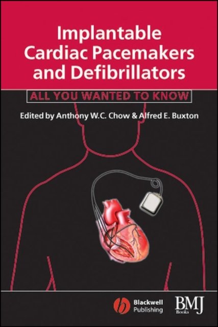 Implantable Cardiac Pacemakers and Defibrillators All You Wanted to Know Chow