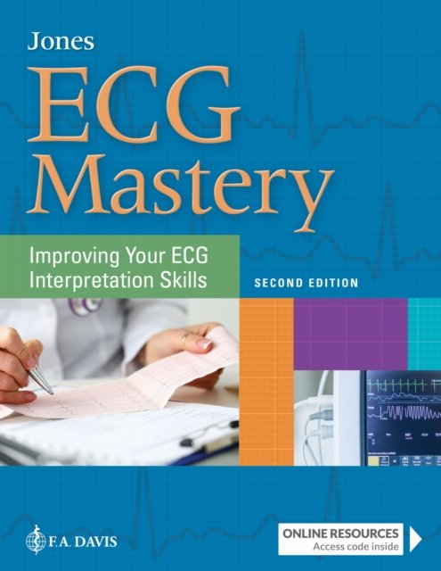 ECG Mastery – Improving Your ECG Interpretation Skills Jones Paperback