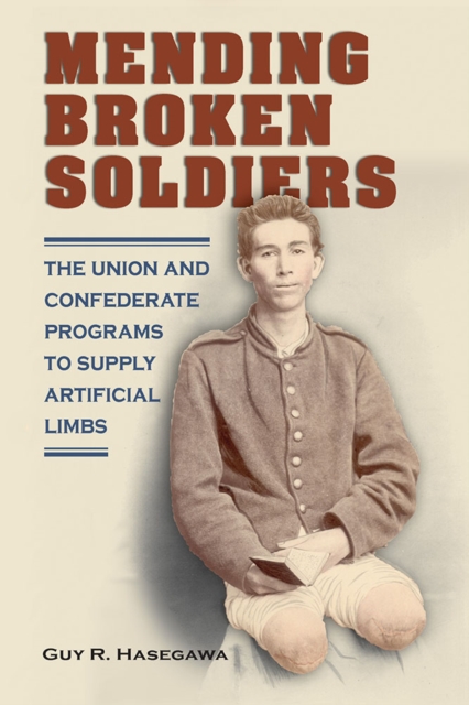Mending Broken Soldiers – The Union and Confederate Programs to Supply Artifici…