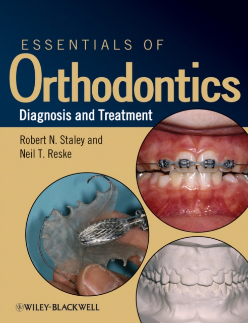 Essentials of Orthodontics – Diagnosis and Treatment Staley Paperback