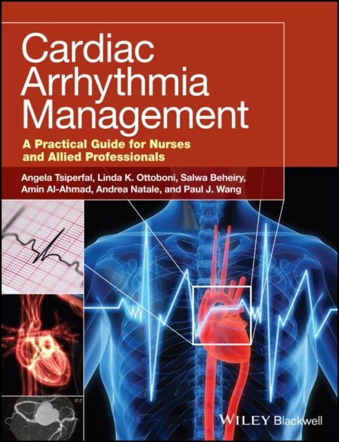 Cardiac Arrhythmia Management – A Practical Guide for Nurses and Allied Profess…
