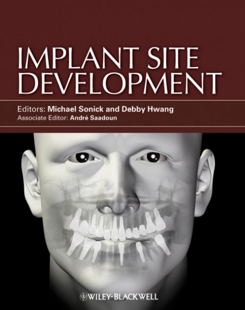 Implant Site Development Sonick Hardback Wiley–Blackwell 9780813825120