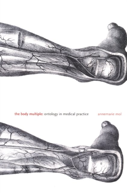 The Body Multiple – Ontology in Medical Practice Mol Paperback 9780822329176