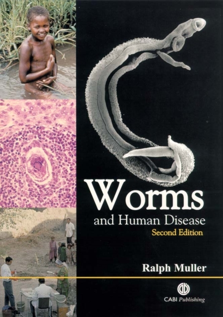 Worms and Human Disease Muller Paperback CABI 9780851995168