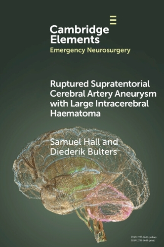 Ruptured Supratentorial Cerebral Artery Aneurysm with Large Intracerebral Haemat