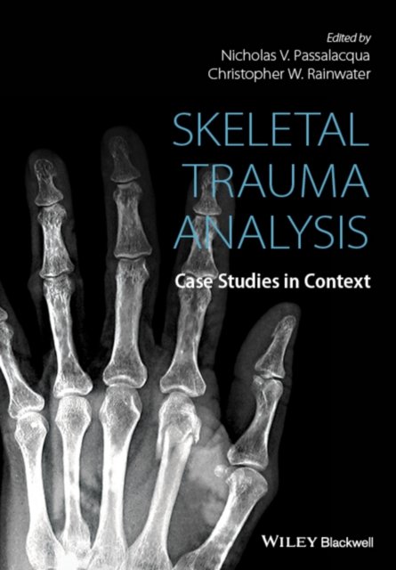 Skeletal Trauma Analysis – Case Studies in Context Passalacqua Hardback
