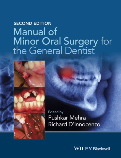 Manual of Minor Oral Surgery for the General Dentist 2e Mehra D′Innocenzo