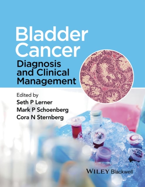 Bladder Cancer – Diagnosis and Clinical Management Lerner Hardback 9781118674840
