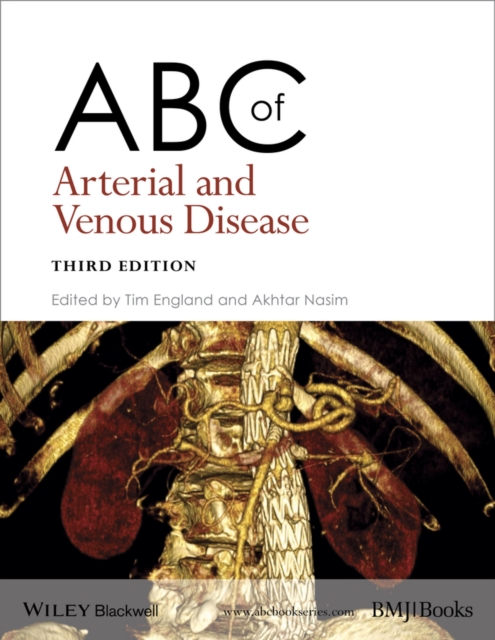 ABC of Arterial and Venous Disease 3e England Paperback Wiley–Blackwell