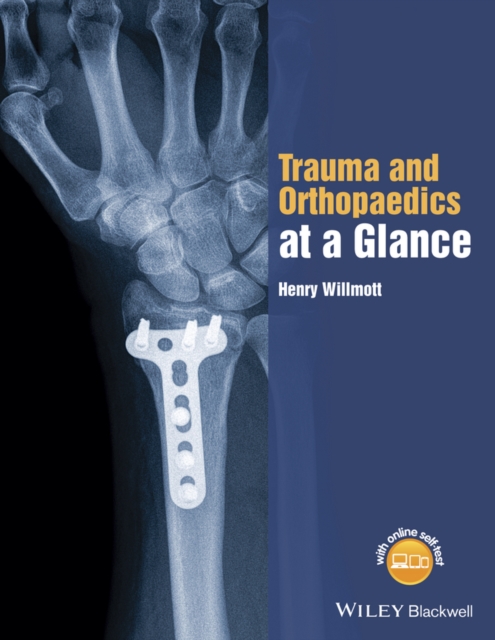 Trauma and Orthopaedics at a Glance Willmott Paperback Wiley–Blackwell