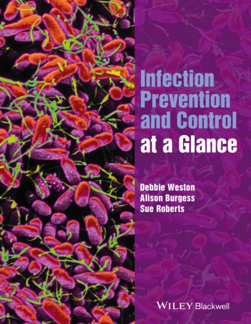 Infection Prevention and Control at a Glance Weston Paperback Wiley–Blackwell