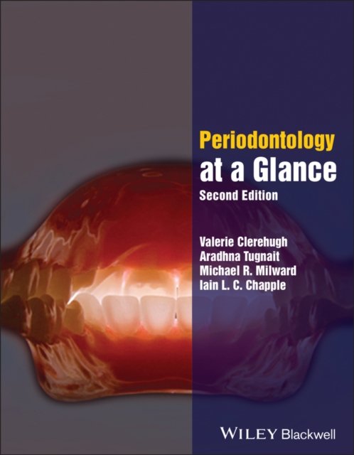 Periodontology at a Glance, 2nd edition Clerehugh Paperback Wiley–Blackwell