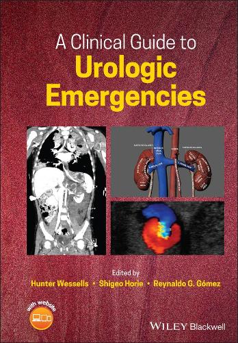 A Clinical Guide to Urologic Emergencies Wessells Hardback Wiley–Blackwell