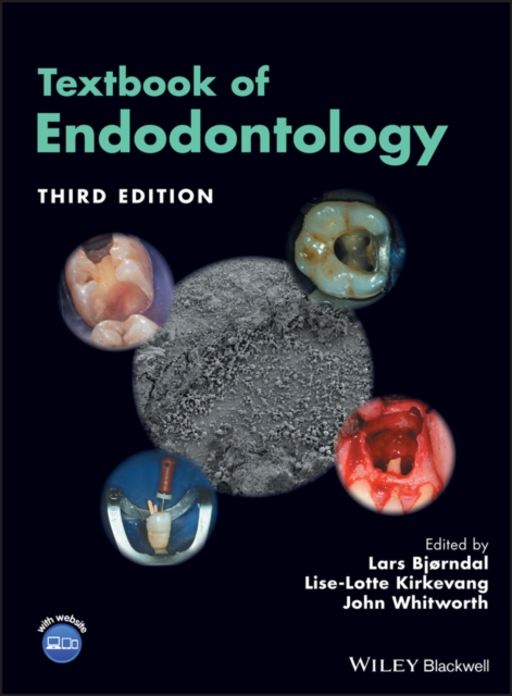 Textbook of Endodontology 3e Bjørndal Hardback Wiley–Blackwell 9781119057314