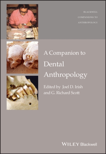 A Companion to Dental Anthropology Irish Paperback John Wiley & Sons