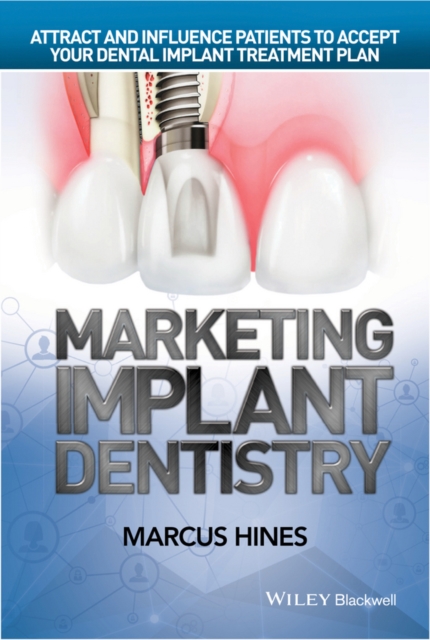 Marketing Implant Dentistry – Attract and Influence Patients to Accept Your Den…