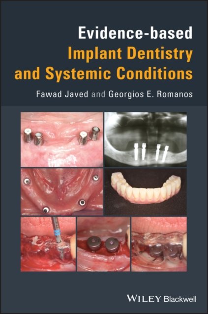Evidence–based Implant Dentistry and Systemic Conditions Javed Hardback