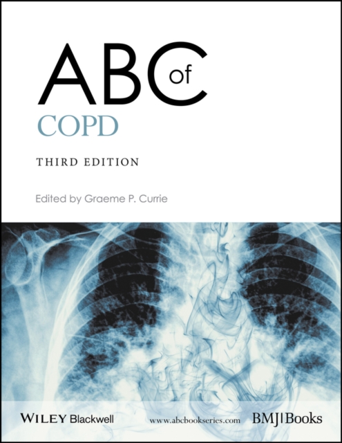 ABC of COPD, 3e Currie Paperback Wiley–Blackwell 9781119212850
